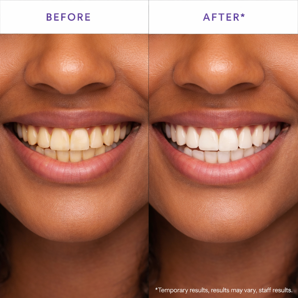 V34 Purple Teeth Whitening Strips – Stain Removal with Whitening & Color Correct